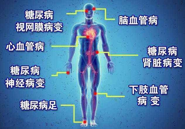 <a href='http://www.zkydsb.com/zskt-tnb/58.html' target='_blank'><u>糖尿病</u></a>并发症的危害