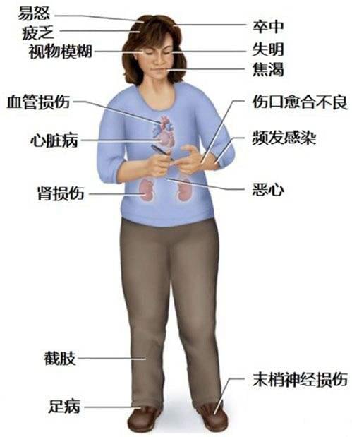 <a href='http://www.zkydsb.com/zskt-tnb/58.html' target='_blank'><u>糖尿病</u></a>并发症