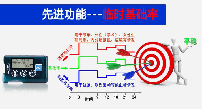 <a href='http://www.zkydsb.com/news-hy/27.html' target='_blank'><u>智凯胰岛素泵</u></a><a href='http://www.zkydsb.com/zskt-beng/101.html' target='_blank'><u>临时基础率</u></a>功能