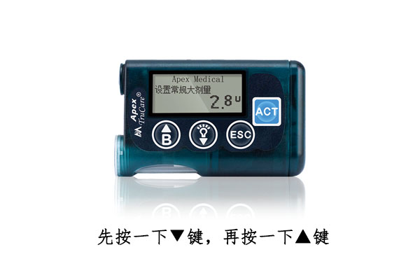 <a href='http://www.zkydsb.com/news-hy/27.html' target='_blank'><u>智凯胰岛素泵</u></a>解锁步骤
