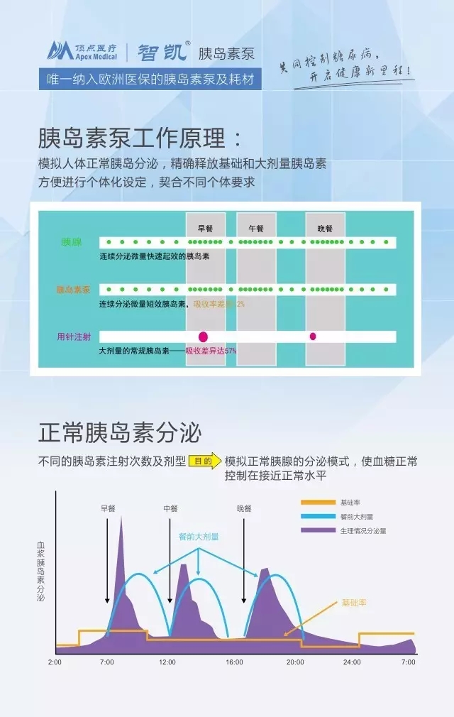 <a href='http://www.zkydsb.com/news-hy/27.html' target='_blank'><u>智凯胰岛素泵</u></a>优势介绍