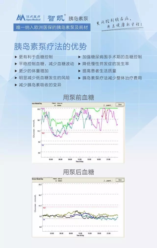 <a href='http://www.zkydsb.com/news-hy/27.html' target='_blank'><u>智凯胰岛素泵</u></a>优势介绍