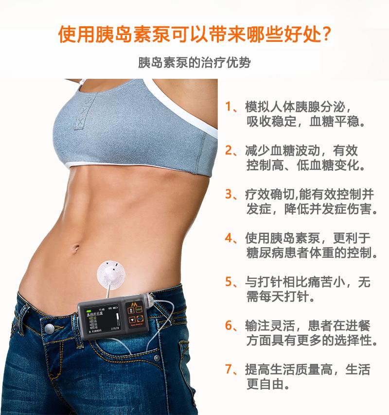 胰岛素泵的治疗优势