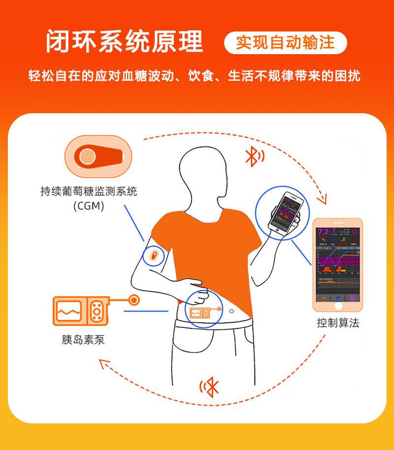 闭环胰岛素泵的原理图
